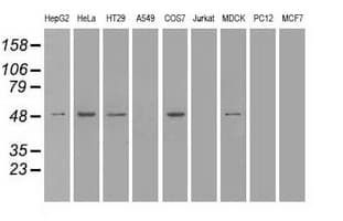 IHC-plus™ SERPINA1 / Alpha 1 Antitrypsin Antibody (clone 15H10)