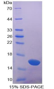 Bovine LGALS1 / Galectin 1 Protein (Recombinant His)