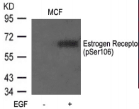 ER Alpha / Estrogen Receptor Antibody