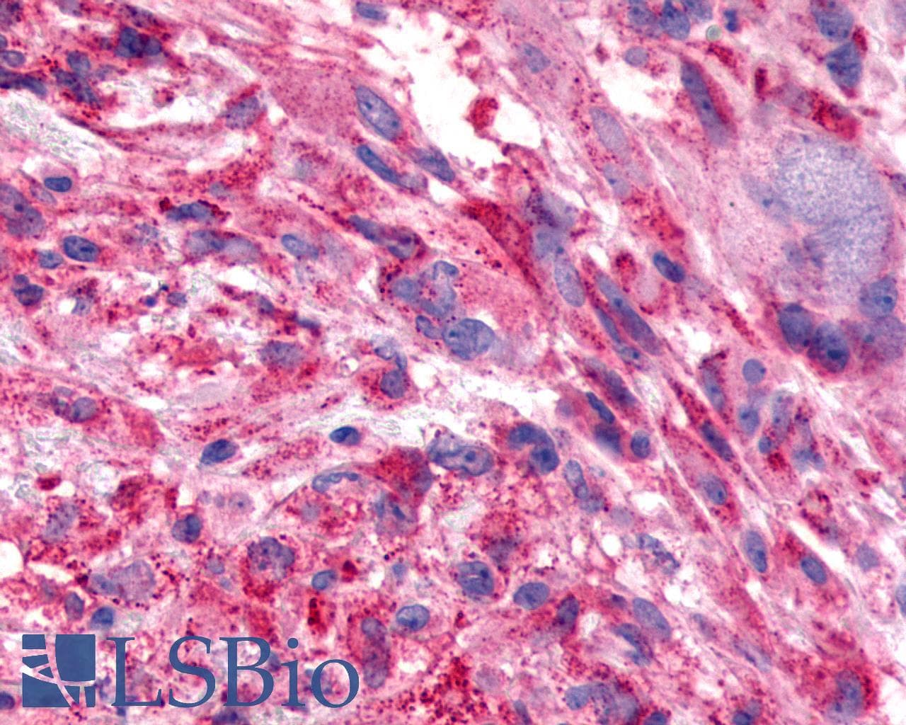 PathPlus™ Polyclonal Rabbit anti-Human FZD7 / Frizzled 7 Antibody (N-Terminus, IHC)