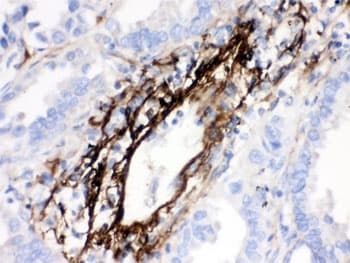 Polyclonal Rabbit anti-Human MGP / Matrix Gla-Protein Antibody (IHC, WB)
