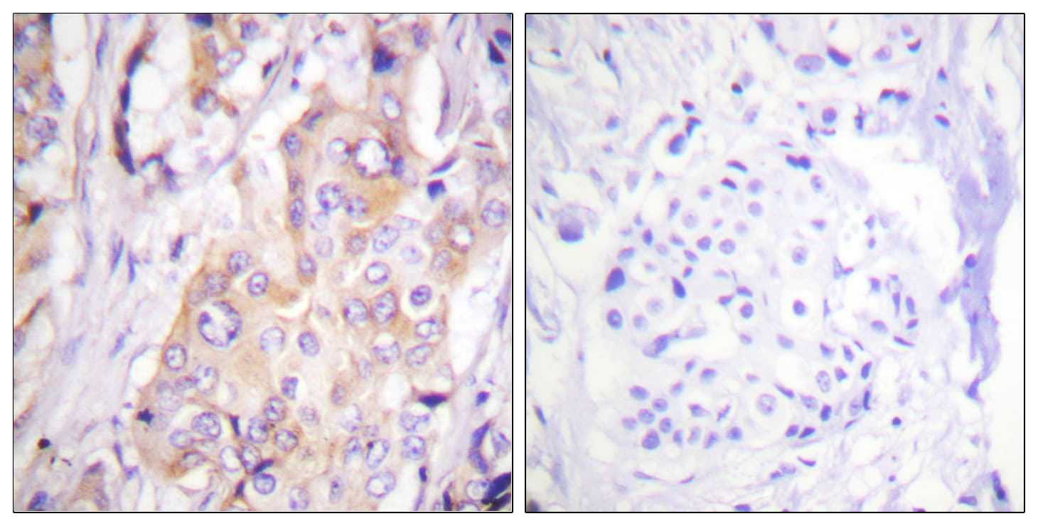 MAP2K1 / MKK1 / MEK1 Antibody (phospho-Thr286)