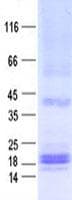 Human MCTS1 Protein (Recombinant His, N-Terminal)