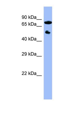 CYP11B2 / Aldosterone Synthase Antibody (C-Terminus)