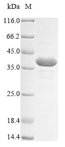 Mouse ASCL2 Protein (Recombinant 10His, N-terminus + Myc, C-terminus)