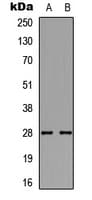 Polyclonal Rabbit anti-Human BAMBI Antibody (Internal, WB)