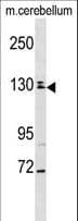 TBC1D8 / AD3 Antibody (aa961-990)