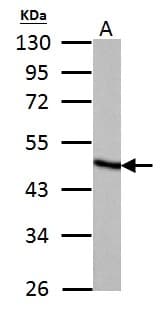 IHC-plus™ FH / Fumarase / MCL Antibody (aa195-473)