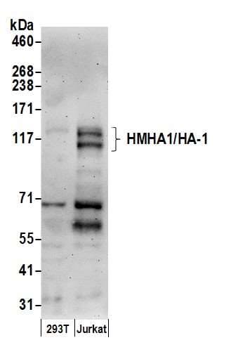 Polyclonal Rabbit anti-Human ARHGAP45 Antibody (aa100-150, WB)