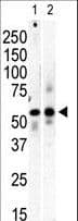 PI4K2B Antibody (aa305-336)