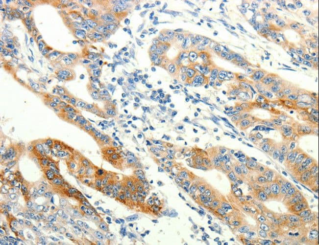 TRPA1 Antibody