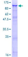 Human DPP4 / CD26 Protein (Recombinant GST)