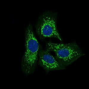 TWF1 / PTK9 Antibody (clone 7C11)