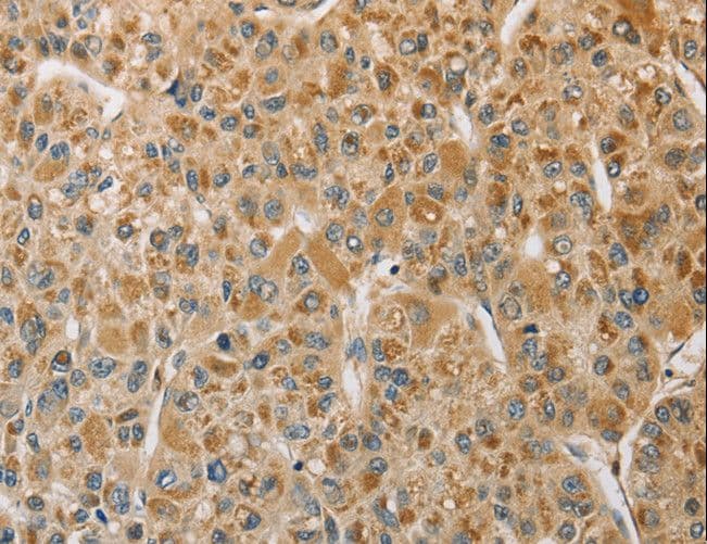 MIP / AQP0 / Aquaporin 0 Antibody