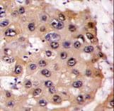 Polyclonal Rabbit anti-Human PSMA5 Antibody (aa106-135, IHC, WB)