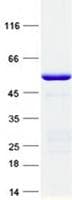 Human DYNC2LI1 / D2LIC Protein (Recombinant GST, N-terminus + His, C-terminus)
