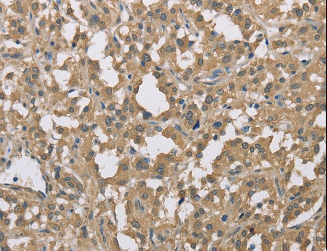 DACH2 Antibody