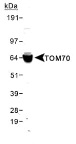 IHC-plus™ TOMM70A Antibody (aa1-100)