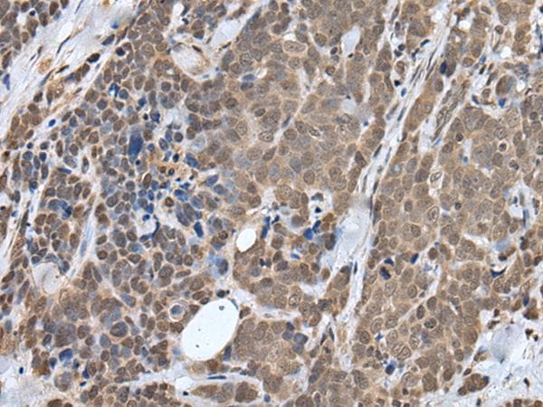 ZNF410 Antibody