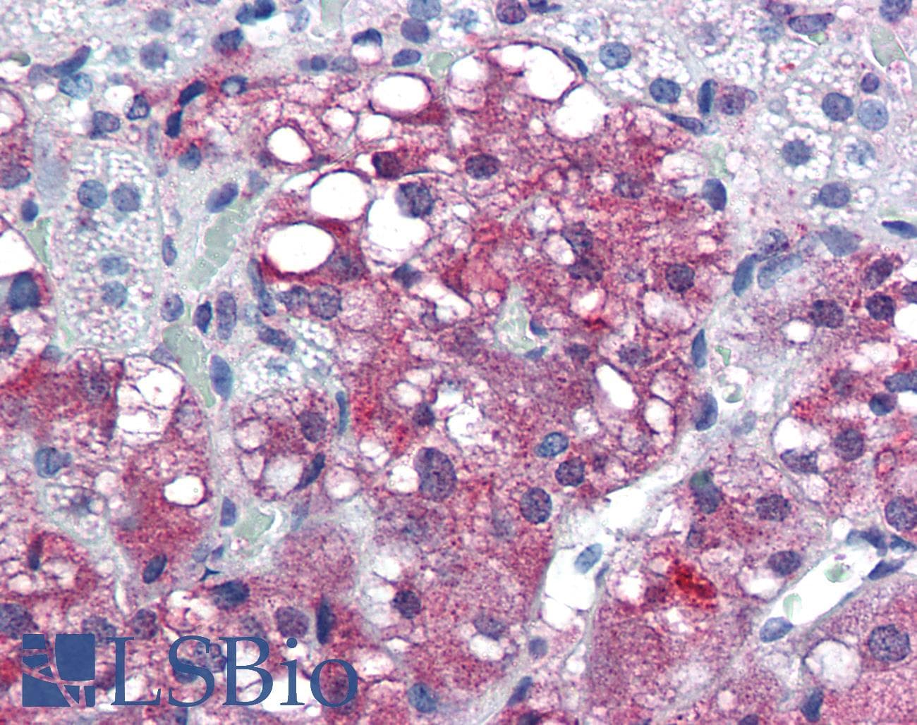IHC-plus™ TRIM3 Antibody (aa2-14)