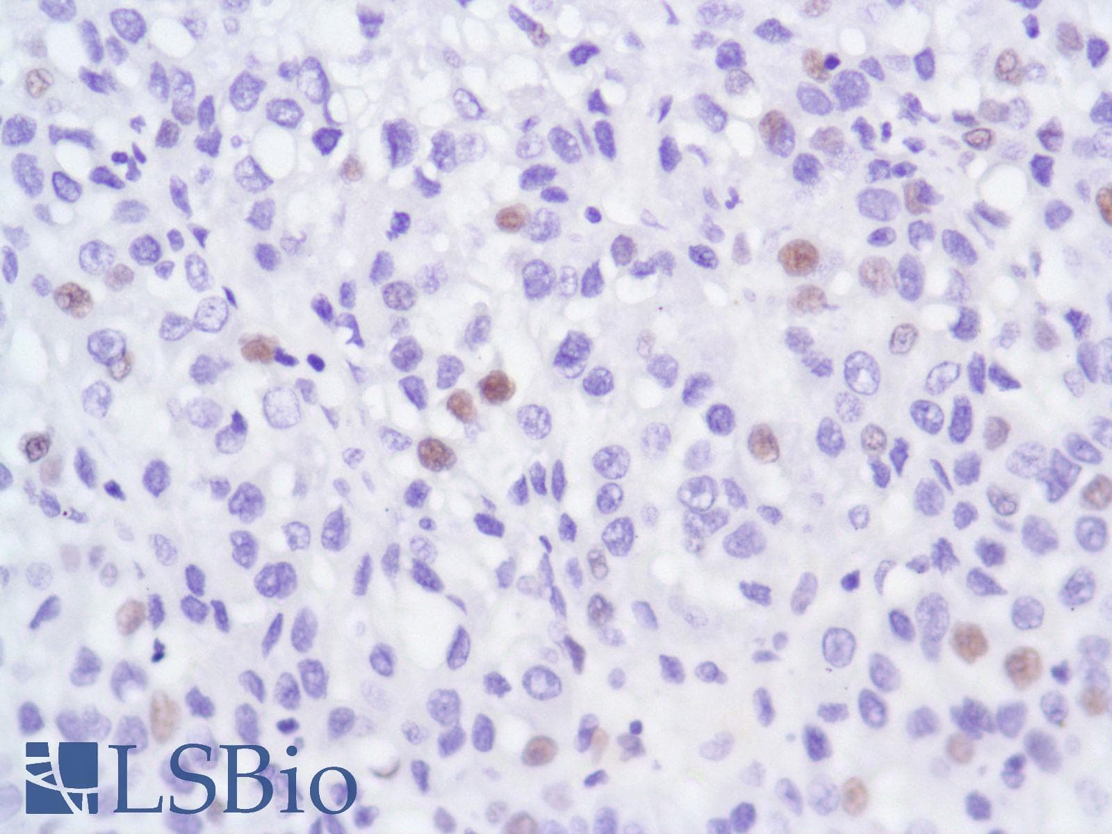 Monoclonal Rabbit anti-Human AR / Androgen Receptor Antibody (clone SP107, N-Terminus, IHC)