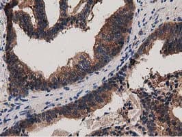 Monoclonal Mouse anti-Human MYD88 Antibody (clone OTI2B2, IHC, IF, WB)