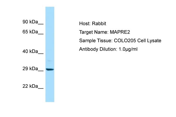 MAPRE2 / EB2 Antibody (aa157-206)