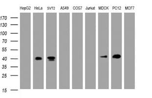 NUDEL / NDEL1 Antibody (clone OTI1G7)