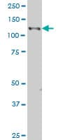 EPHB3 / EPH Receptor B3 Antibody (clone 2G9)
