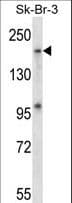MAP4K4 Antibody (aa506-534)