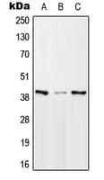 MTERF1 Antibody (Internal)