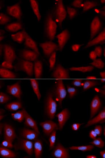 Polyclonal Rabbit anti-Human WIF1 Antibody (IHC, IF, WB)