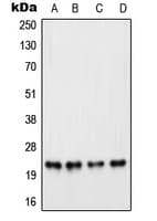 Polyclonal Rabbit anti-Human PARP1 Antibody (Internal, WB)