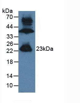 GREM1 / Gremlin-1 Antibody (aa26-184)