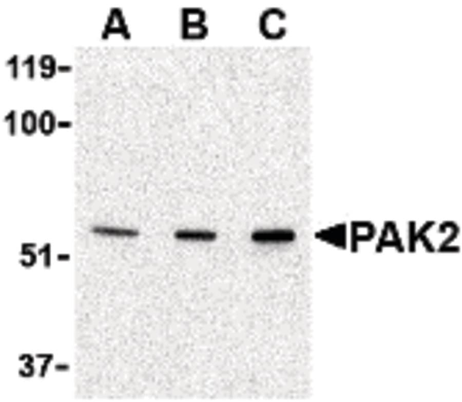 IHC-plus™ PAK2 Antibody