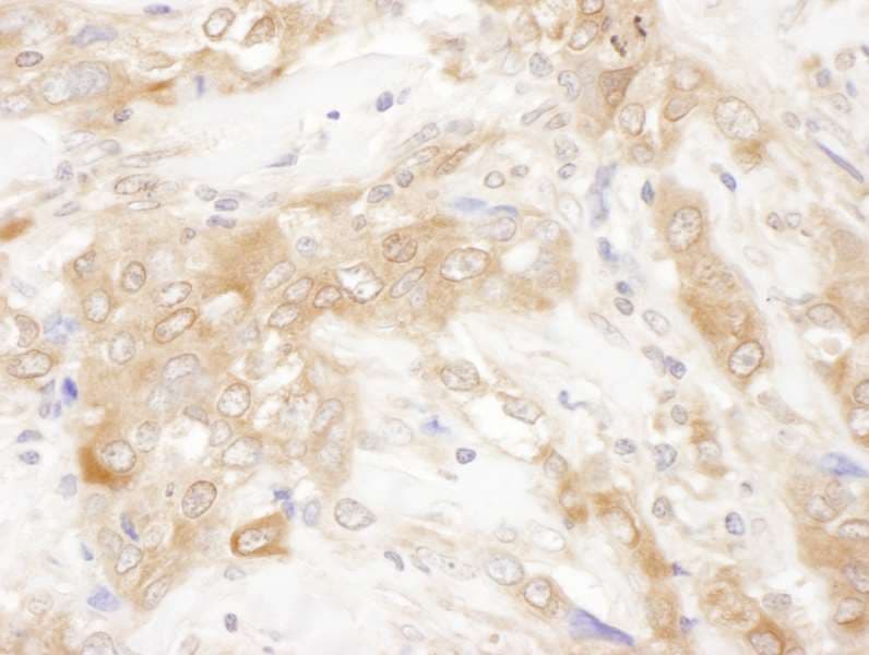 Polyclonal Rabbit anti-Human CHMP2B Antibody (aa163-213, IHC, WB)