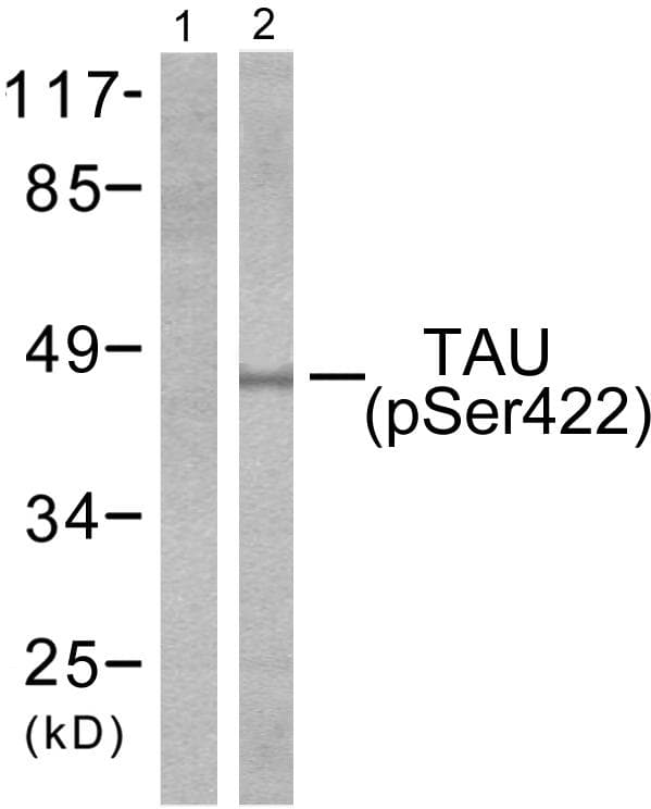 Polyclonal Rabbit anti-Human MAPT / Tau Antibody (phospho-Ser422, IHC, WB)