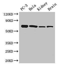 IHC-plus™ Polyclonal Rabbit anti-Human GPI Antibody (aa2-554, IHC, IF, WB)