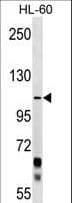 PCDHA10 Antibody (aa771-798)