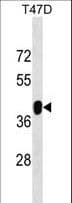 ZNF322 Antibody (aa326-352)
