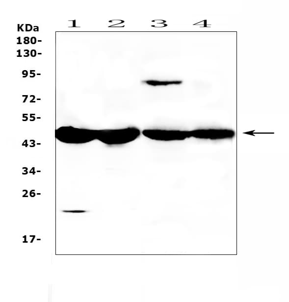 Polyclonal Rabbit anti-Rat ADA / Adenosine Deaminase Antibody (IHC, WB)