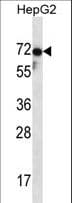 Polyclonal Rabbit anti-Human ZP1 Antibody (aa536-565, WB)