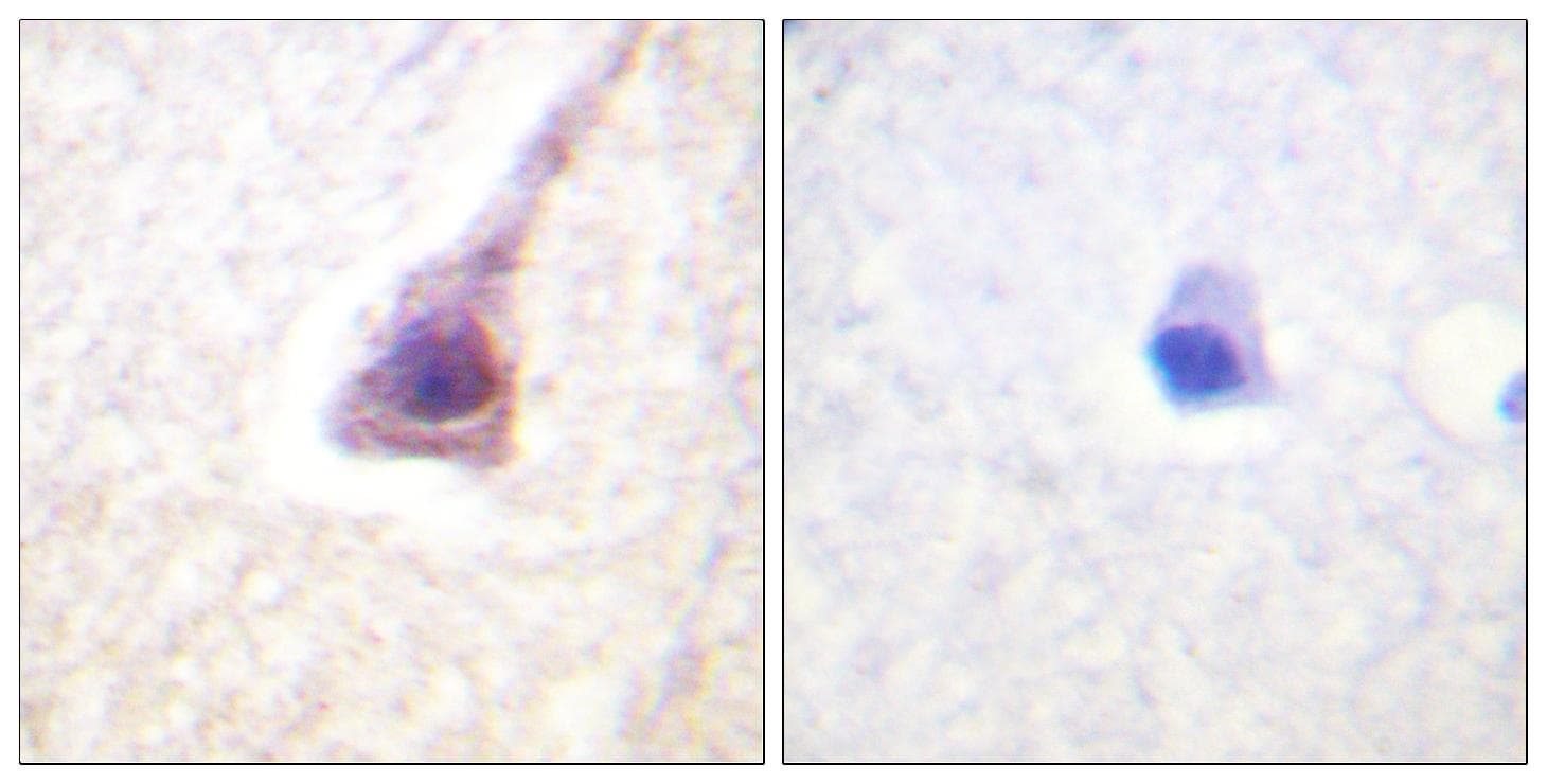 PTP1B Antibody (phospho-Ser50)