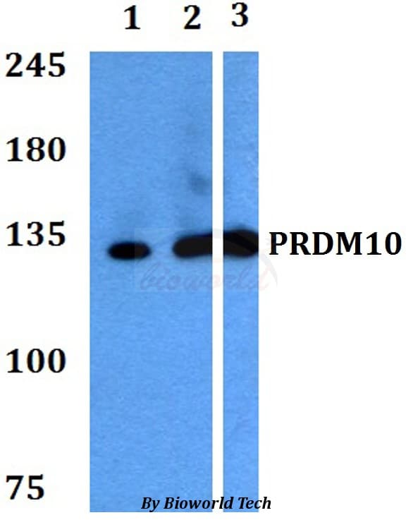 PRDM10 / TRIS Antibody