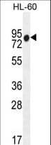 ZNF665 Antibody (aa70-99)