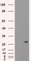 Monoclonal Mouse anti-Human TNNI3 / Cardiac Troponin I Antibody (clone OTI3G2, IHC, WB)
