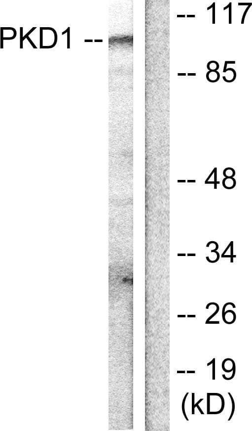 PRKD1 / PKC Mu Antibody (p205)