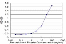 Monoclonal Mouse anti-Human MYCN / N-myc Antibody (clone 4H4, WB)