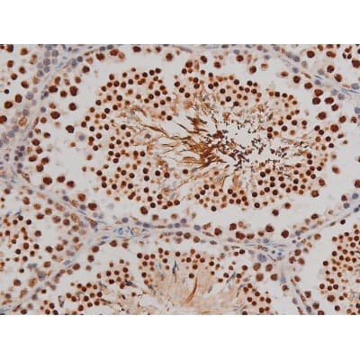 Polyclonal Rabbit anti-Human FLNA / Filamin A Antibody (phospho-Ser2152, IHC, IF, WB)
