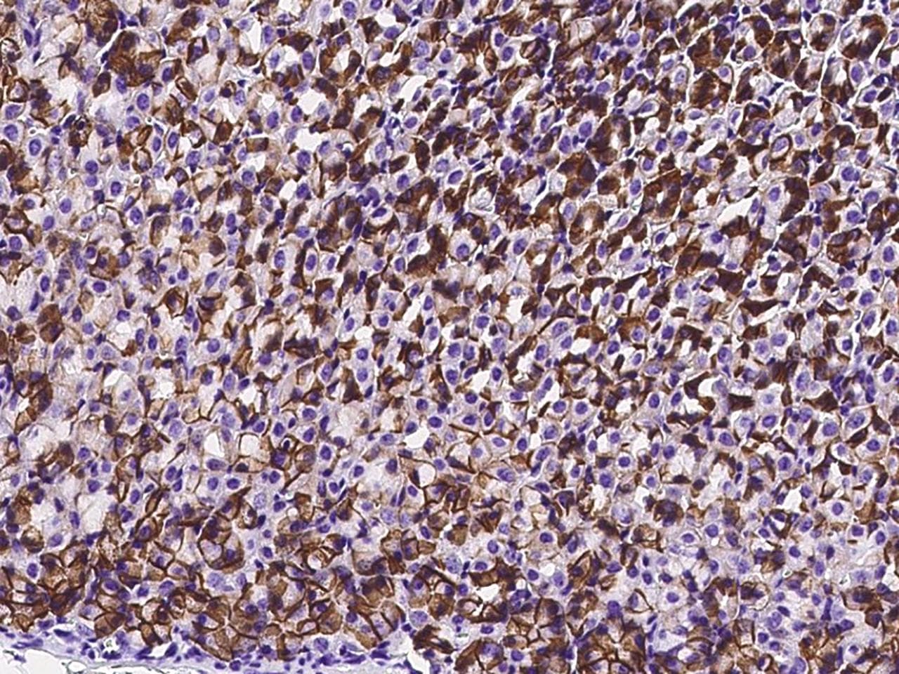 Polyclonal Rabbit anti-Mouse CA9 / Carbonic Anhydrase IX Antibody (IHC)